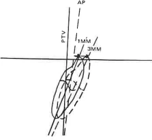 Manual Illustration